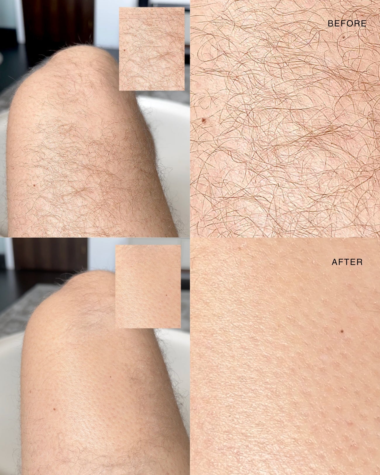 Answr Exfoliating hair removal drop