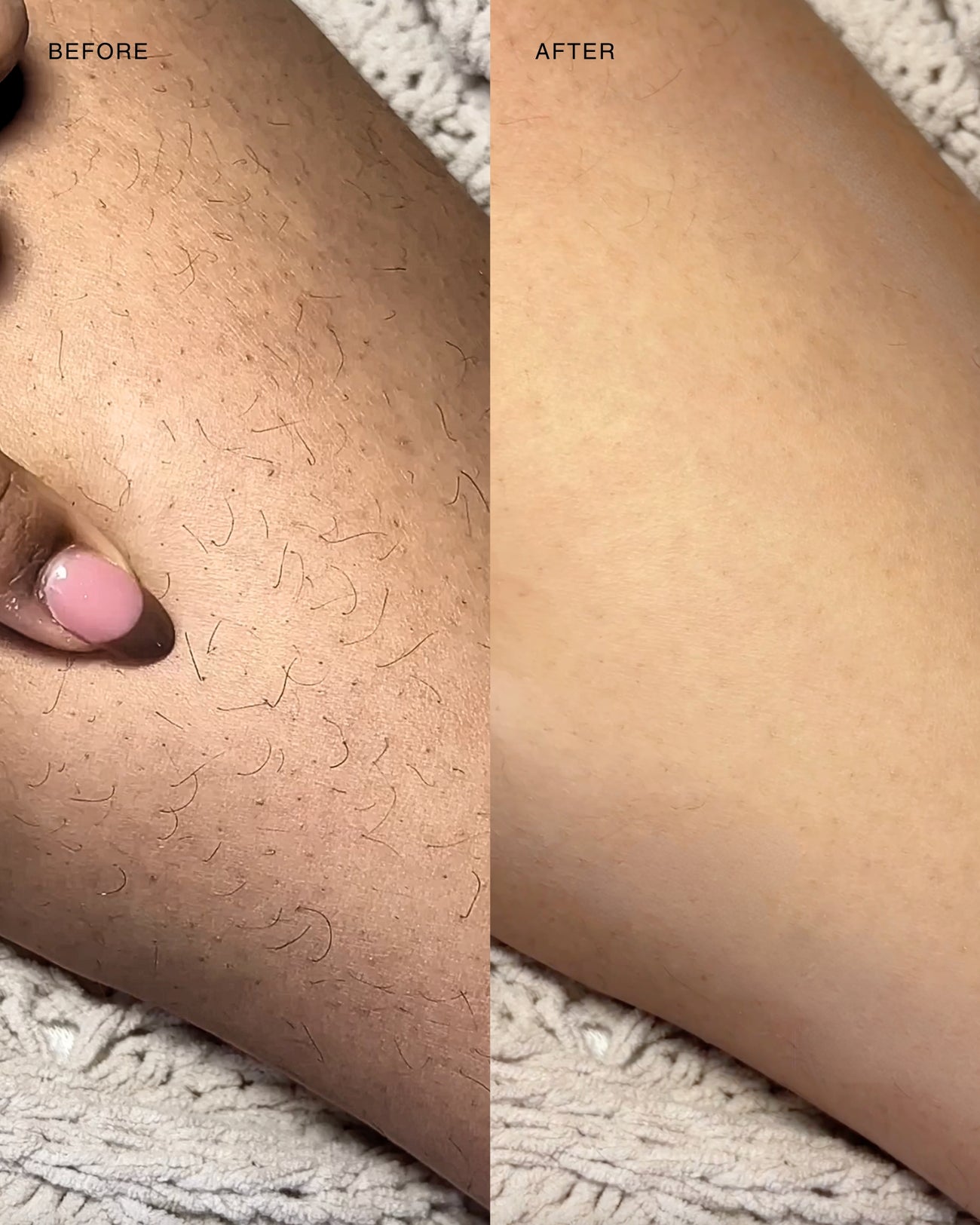 Answr Exfoliating hair removal drop