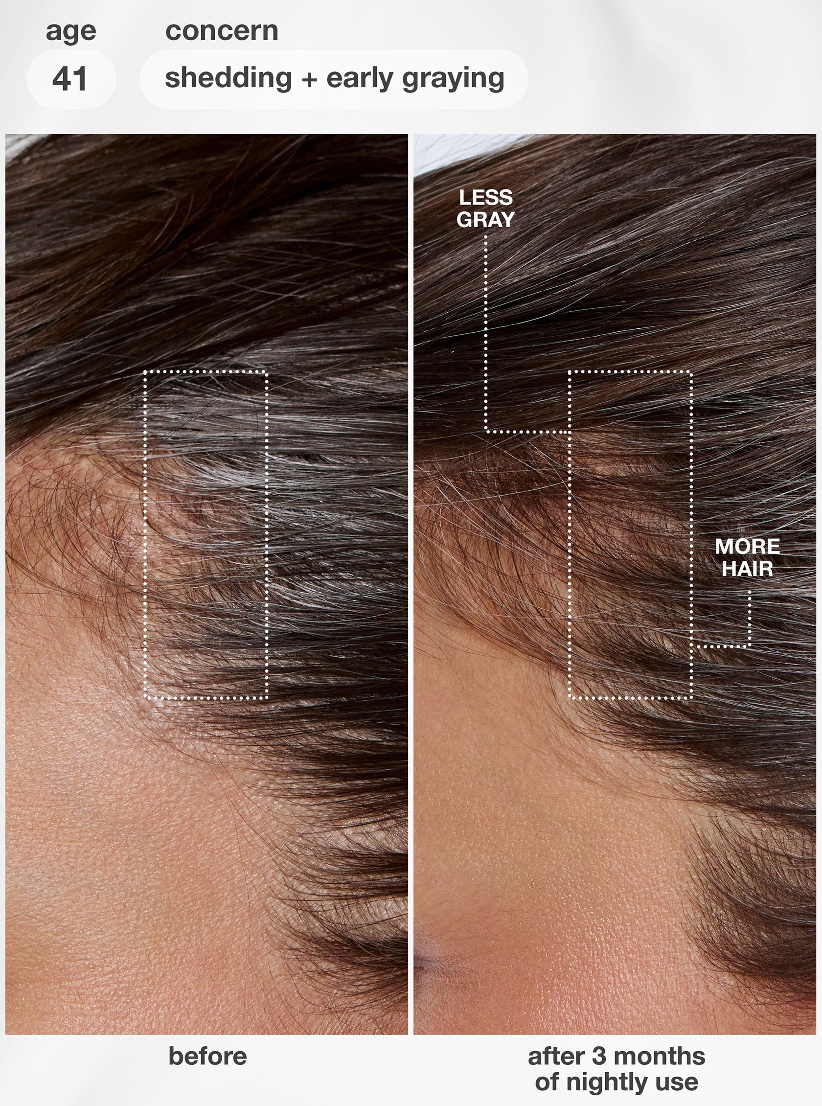K18 FutureIQ biomimetic hair longevity serum